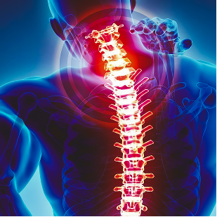Persistent back pain