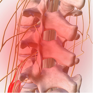 Pain treatment illustration