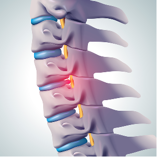 Pain treatment illustration